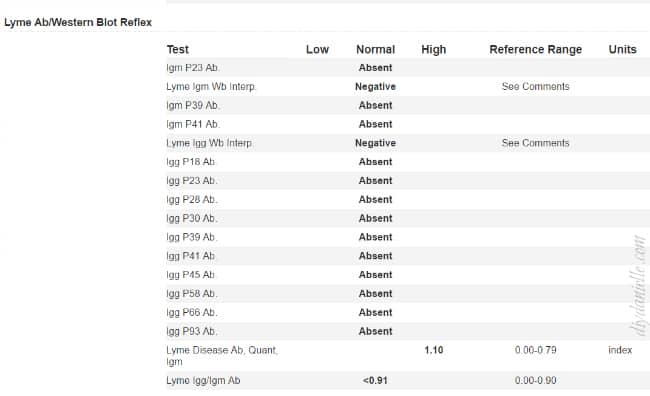 Test results for Lyme, negative results for someone with a prior positive.