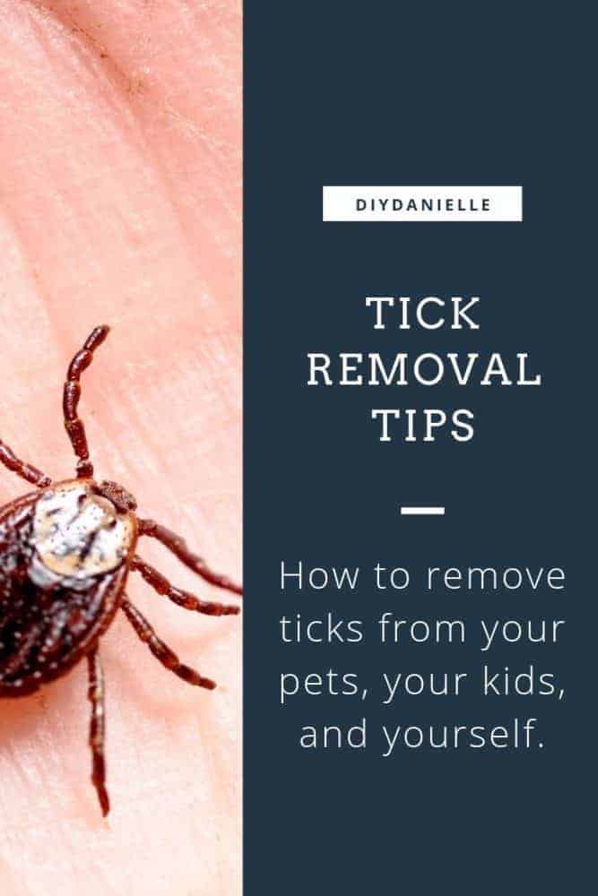 Tick removal tips: How to remove ticks from your pets, your kids, and yourself.